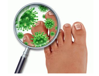 Symptomer vum Pilzes